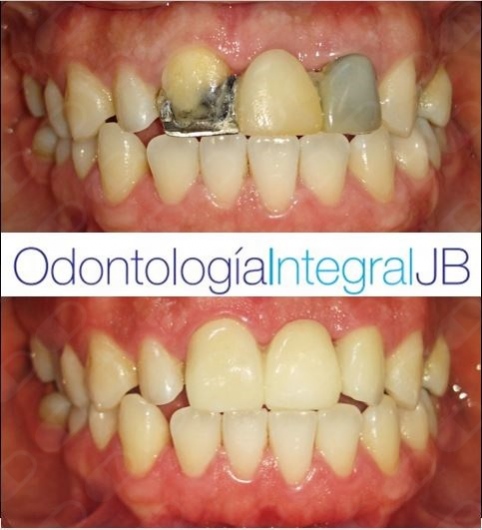 Jacqueline Bazán Díaz-21