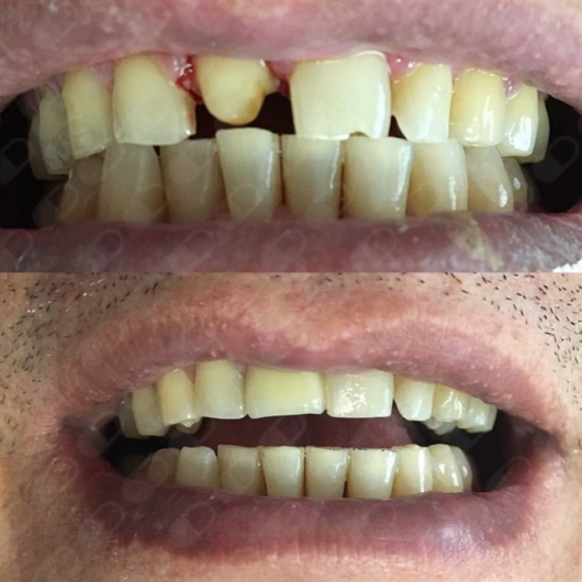 Analí García García-8