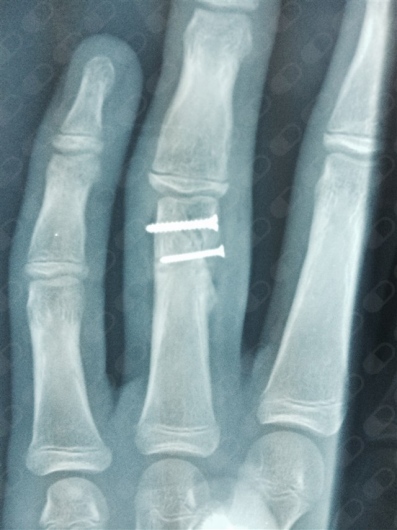 Miguel Angel Hernández Alvarez-2