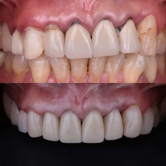 Hugo Moran Negrete-15