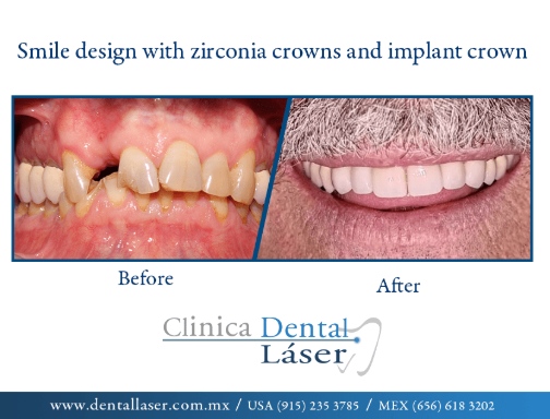 Zonia Edith Barrandey Orozco-8