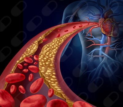 Miguel Ángel Puente Lárraga-8