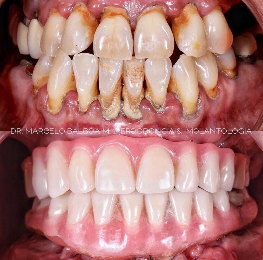 Marcelo Balboa Melgarejo-2