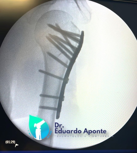 Juan Eduardo Aponte Fonseca-5