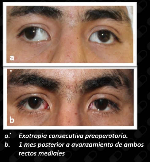 Ana Marcky Parra Robles-5