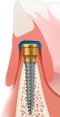 Leonel Palma Carlos-27