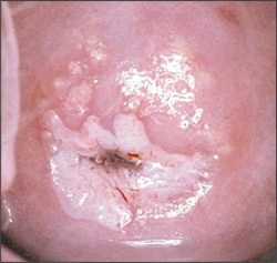 María José Chiriboga Zambrano-4