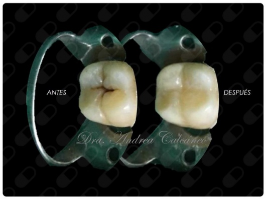 Andrea Calcáneo Castañeda-7