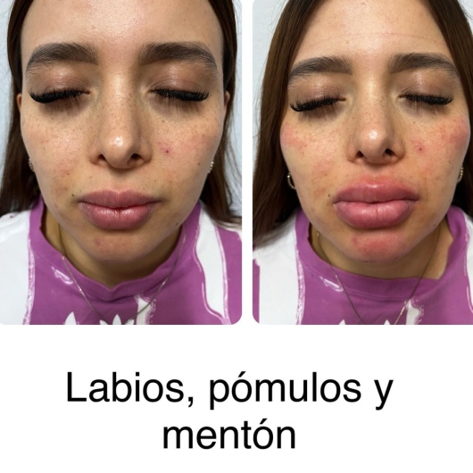 Arturo Romero Grande-14