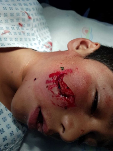 Valerio Licerio De La Cruz-19