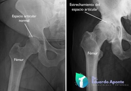 Juan Eduardo Aponte Fonseca-2