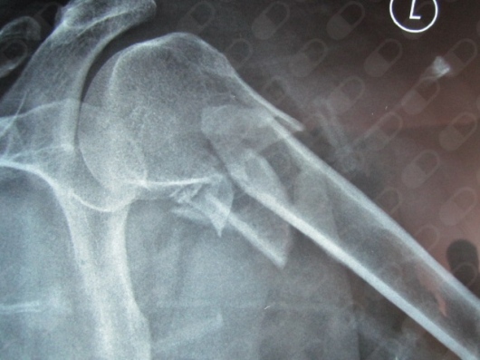 Luis Enrique Pérez Chávez-6