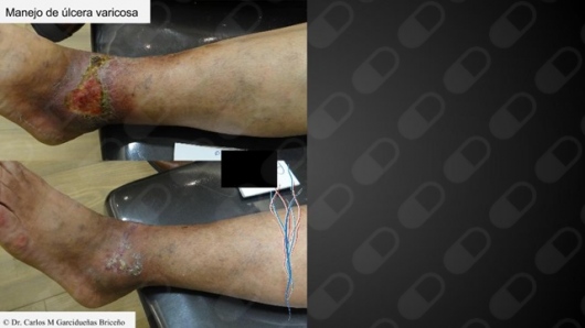 Carlos Mario Garcidueñas Briceño-11