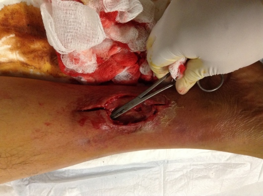 Edson Sergio Sánchez Olguín-5