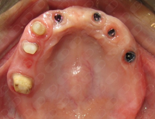 Alejandro Caballero P.-5