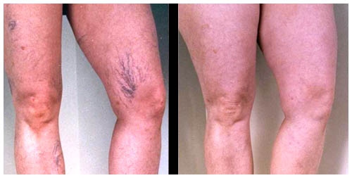 Boris Mederos Osorio-5