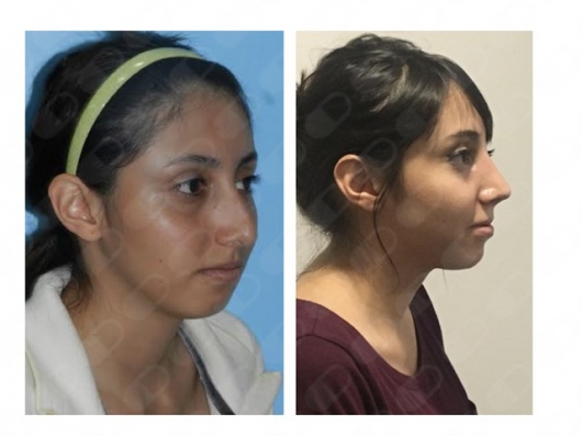 Blanca Santos Mejía-7