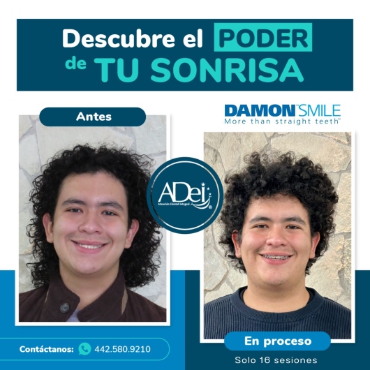 Víctor Amador-3