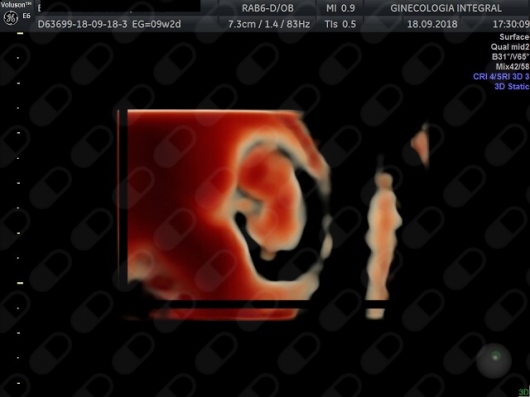 Oscar Alejandro Sánchez Gámez-25