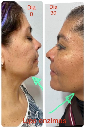 Arturo Romero Grande-6