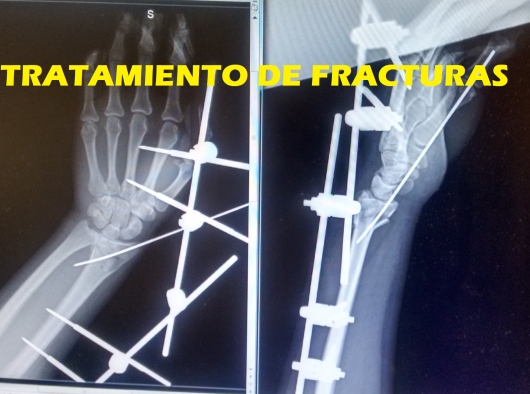 Gerardo Segundo Primero-14