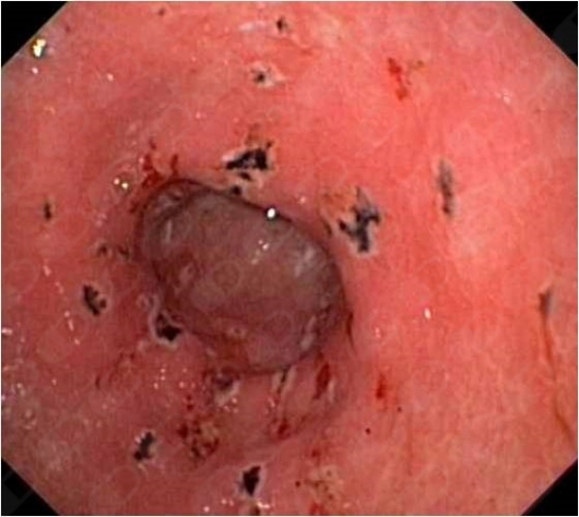 Tonantzin Noemi Lujano Salgado-6