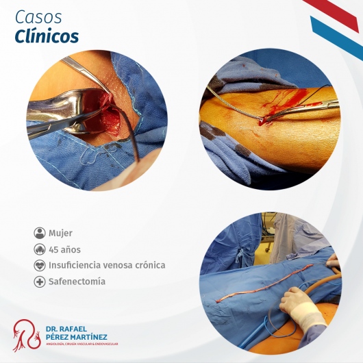 Rafael Pérez Martínez-0