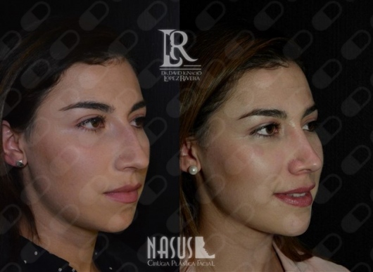 David Ignacio López Rivera-8