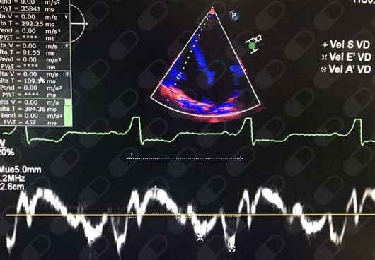 Omar Alejandro Márquez Valero-2