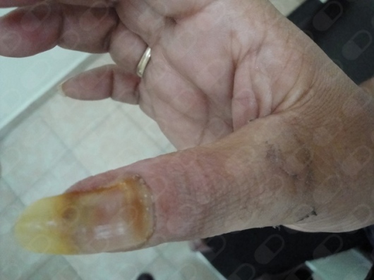 Angel Manuel Piña Jaén-3