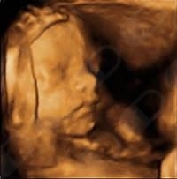 Lucía Alejandra Román Tijerina-5