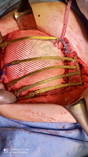 Gildardo Cortes Julian-17