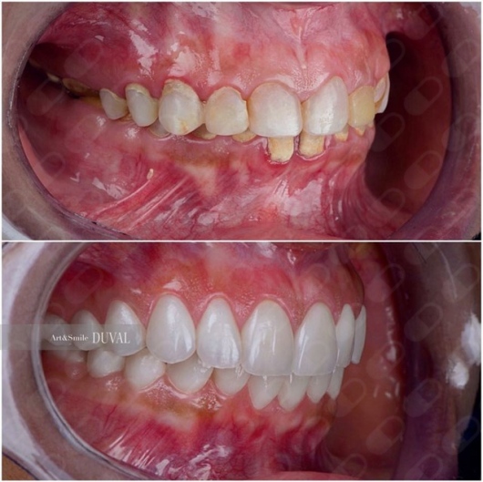 Maria Teresa Alvarado Burgos-5