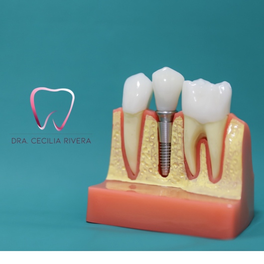 Cecilia Rivera Elizalde-3