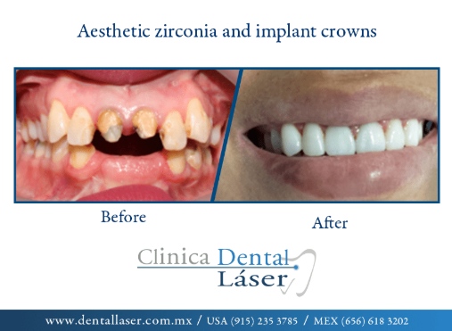 Zonia Edith Barrandey Orozco-7