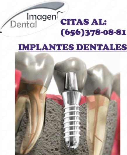 Leonel Palma Carlos-8