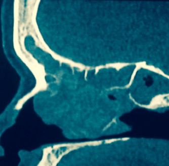 Eduardo Ivan Acuña Ramirez-3