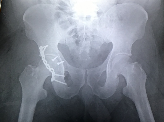 Josué Jonatan Arcia Guzmán-2