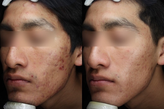 Dafne Arellano Montalvo-45