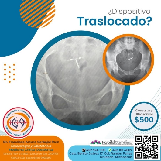 Francisco Carbajal-29