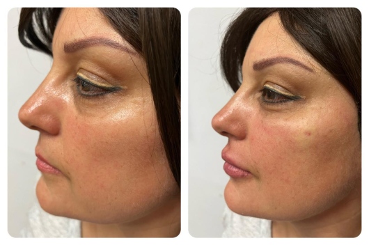 Arturo Romero Grande-12