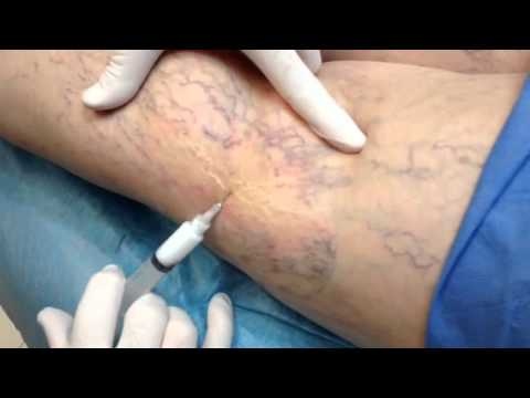 Boris Mederos Osorio-0