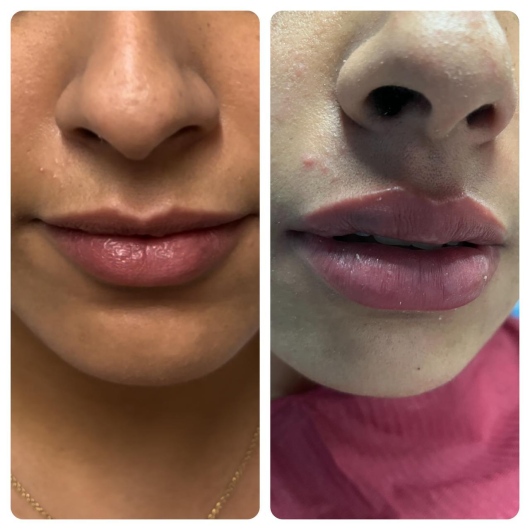 Arturo Romero Grande-4