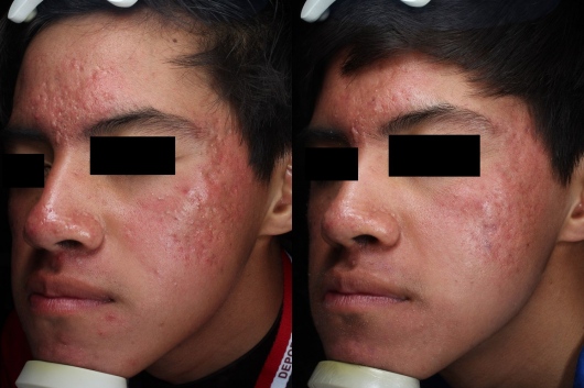 Dafne Arellano Montalvo-47