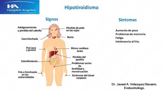 Jassel Velázquez Navarro-7
