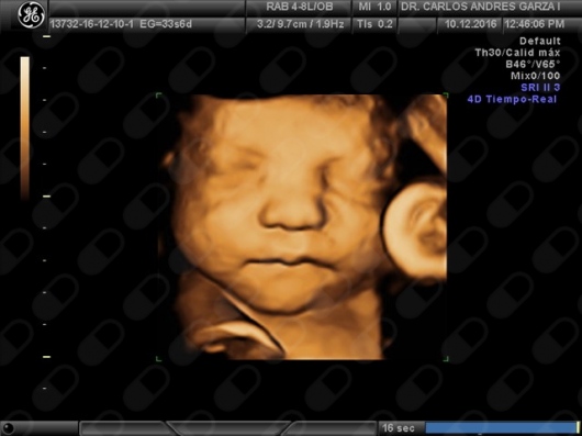 Carlos Andrés Garza Flores-11