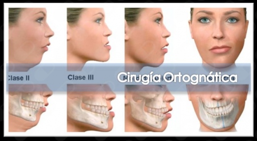 Laura Karina Uribe Fentanes-16