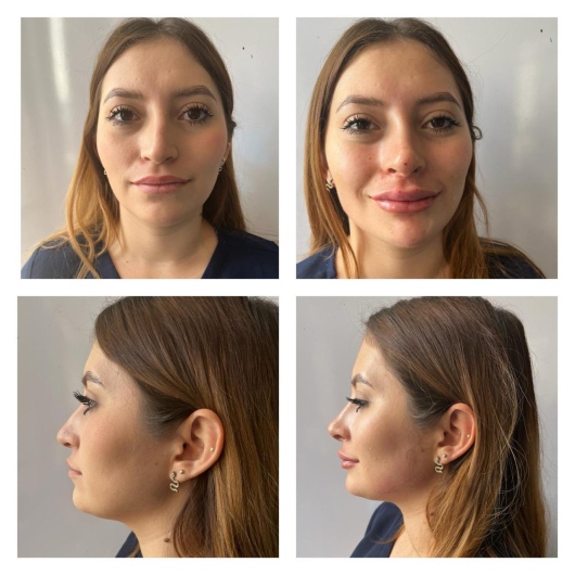 Arturo Romero Grande-24