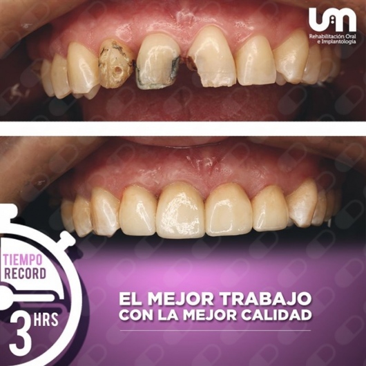 Alejandro Uribe Marioni-10