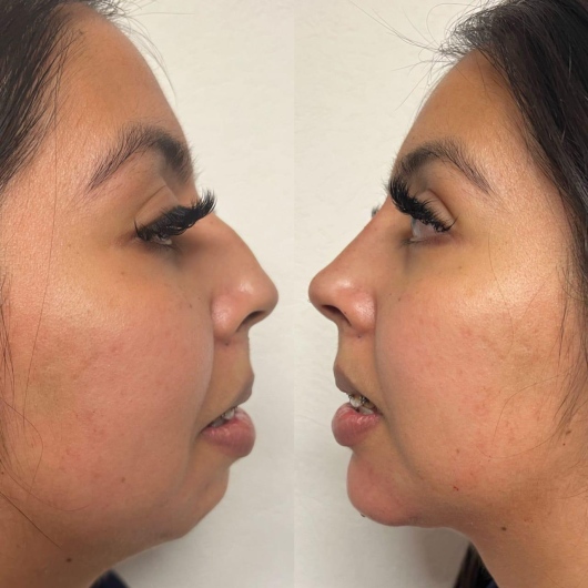 Arturo Romero Grande-23